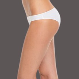 Brazilian Butt Lift